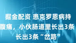 掘金配资 患克罗恩病持续腹泻腹痛，小伙肠道里长出3条“岔路”